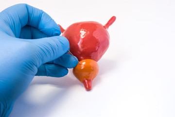 Prostate gland tissue biopsy procedure. Urologist holding needle and makes body puncture of anatomical prostate organ. Obtaining samples of prostate tissue for diagnostic manipulations for diagnostics
