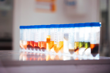 food samples in tubes in a laboratory