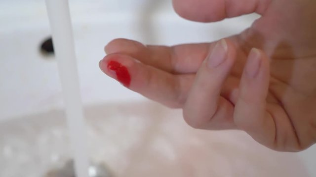 blood flows from a wound on the middle finger of a woman. 4k