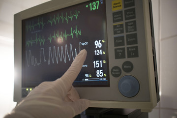 doctor's hand indicates the patient's heart monitoring in the intensive care unit. concept of pandemic, coronavirus, virus, disinfection, panic.