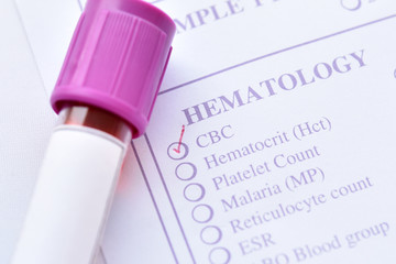 Blood sample for complete blood count (CBC) test