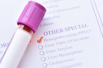 Blood sample for hemoglobin typing test, diagnosis for thalassemia disease