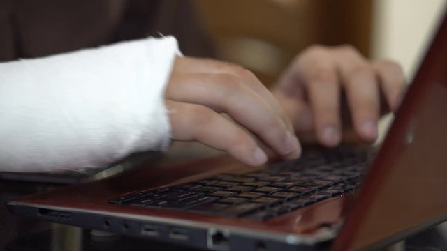 A man with a broken right hand is working remotely at home near a laptop. A fracture of the hand led to disability. Health insurance. Hands close-up