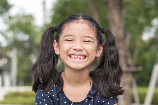 Asian girl child showing front teeth with big smile