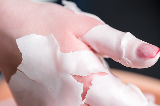 Process paraffin treatment of female hands in beauty salon