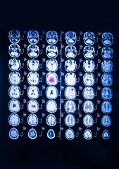 mri scan or magnetic resonance image of head and brain scan.