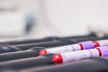 Clinical analysis tubes, usually used for blood tests.