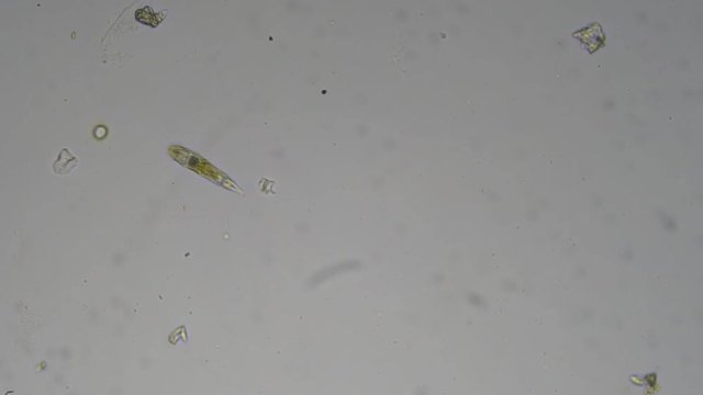 Baby of triops under a microscope. The microscopic world.