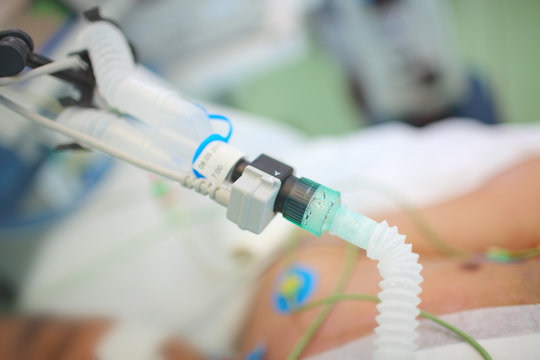 Patient in the ICU connected to the artificial lung ventilation system