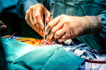 instruments in the hands of a cardiac surgeon during an operation.
