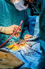 The surgeon during the operation removes blood from the wound with a medical suction.
