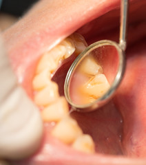 Fototapeta na wymiar A dentist makes teeth to a woman