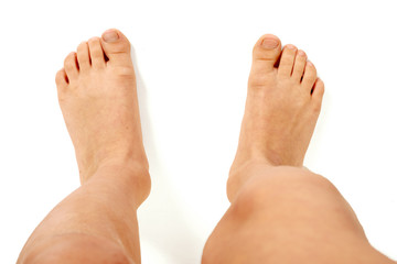 Top-view of young barefoot kid with splayfoot on white background