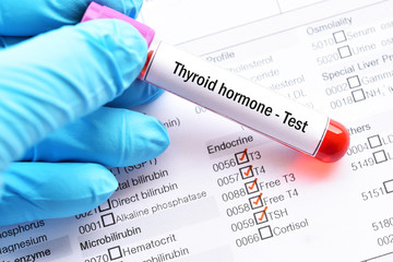 Blood sample for thyroid hormone test