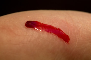 deep cut caused by knife in hand palm
