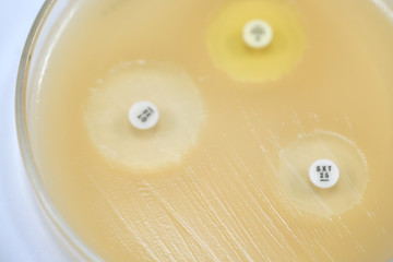 Antibiotic sensitivity of bacteria by means of diffusion test is a test.