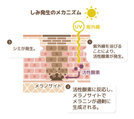 皮膚断面図 健康な皮膚とダメージを受けた皮膚の比較図 Wall Mural Barks 皮膚断面図 健康な皮膚とダメージを受けた皮膚の比較図 Wall Mural Barks
