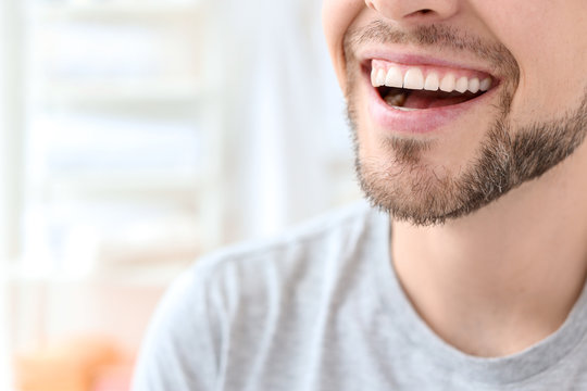 Young Man With Beautiful Smile Indoors. Teeth Whitening