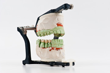 Dental articulator. Lateral view of a adjustable dental articulator with teeth implanted model isolated on the white background.