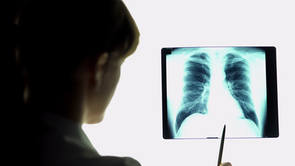 Therapist analyzing pneumonia lungs x-ray image, making conclusions, healthcare
