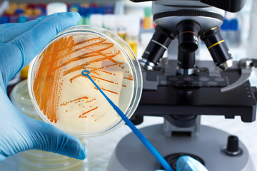 hand of technician holding plate with bacterial colonies of Streptococcus agalactiae and microscope in background / Colonies of bacteria Streptococcus agalactiae in culture medium plate 