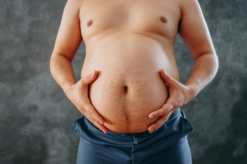 Overweight man touching his belly with hands. Weight losing, dieting, healthcare concept