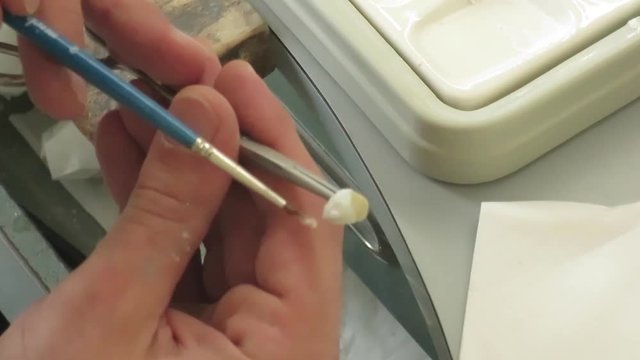 odontotecnico modellazione e lavorazione dente 