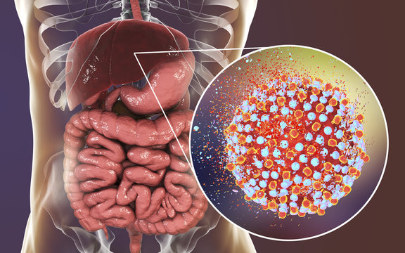 Treatment of hepatitis C virus infection, conceptual image, 3D illustration showing destruction of hepatitis C viruses
