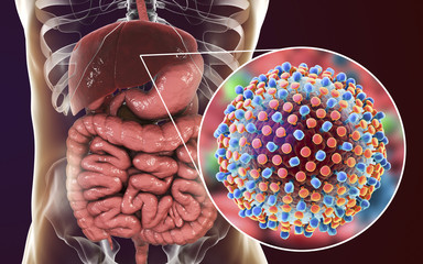 Hepatitis C virus infection medical concept, 3D illustration