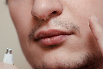 Herpes on lips of the young man. Shocked man touching pain her nose. Inflammation of the lip. Beauty concept.  Man nose infected herpes virus. Man smears herpes with herpes cream.