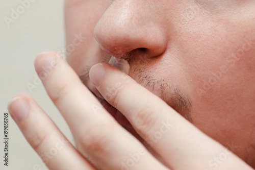 Herpes On Lips Of The Young Man Shocked Man Touching Pain Her Nose