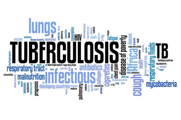 Tuberculosis sign