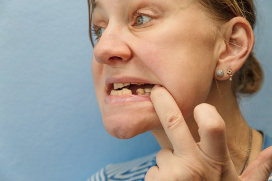 Women, showing mouth without tooth (broken) using fingers