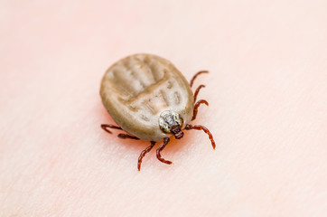 Encephalitis Virus or Lyme Disease or Monkey Fever Infected Tick Arachnid Insect on Skin
