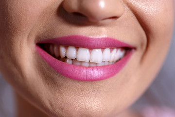 Woman smile. Teeth whitening. Dental care health background.