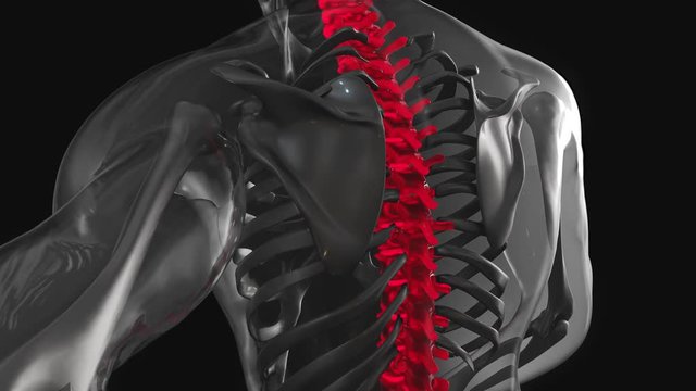 Pain in Spine animation