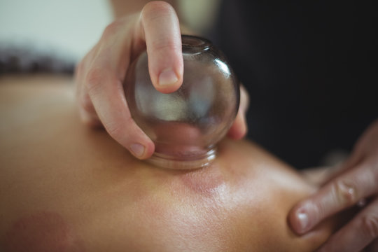 Close-up of therapist giving cupping therapy to man