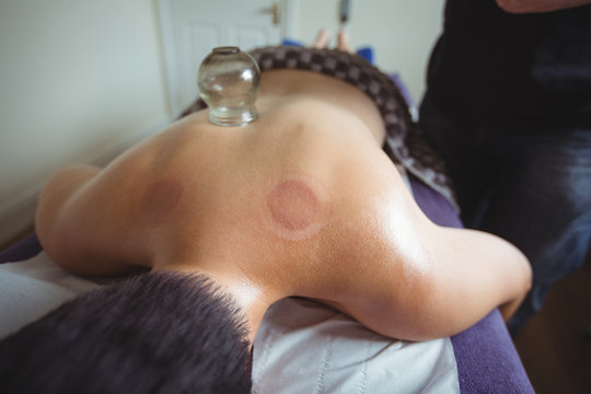 Man receiving cupping therapy