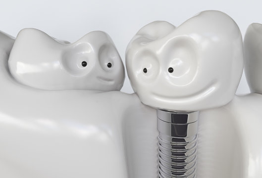 Tooth human cartoon implant - 3D Rendering