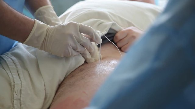 A stunning closeup of orthopedic surgeons sewing up a hip wound of a patient with an ill coxal joint. They use a white string and a big needle