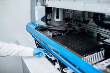 Close-up view on the hand putting samples into the medical analyzer
