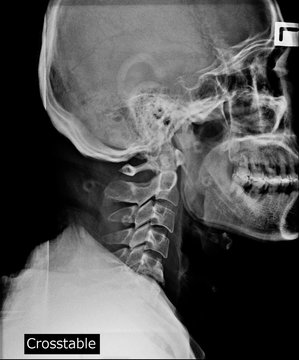 skull and neck x-ray side view