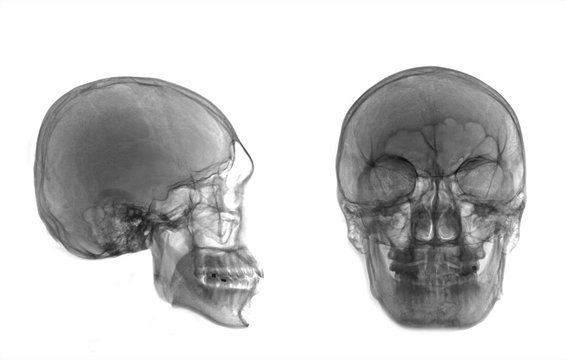Very good quality X-ray image of normal human skull front (AP) view and side (Lateral) view, Invert from normal tone, isolated on white background.