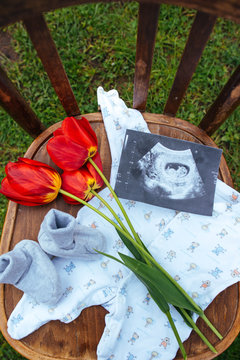 red tulips, photography with ultrasound and children's clothing