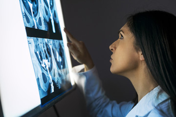 Young female doctor examining the medical x-ray image in hospital office.