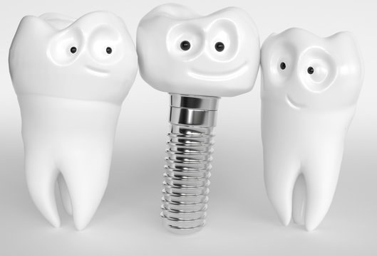 Tooth human cartoon implant - 3D Rendering