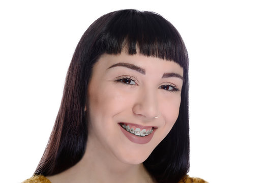 Young woman wearing braces on white background