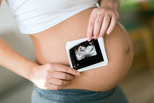 Pregnant woman holding ultrasound photo on belly
