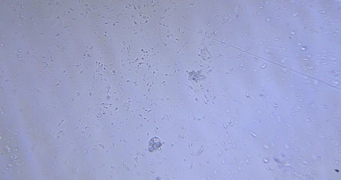 semen under a microscope