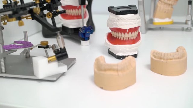 Jaw tooth model in dental clinic